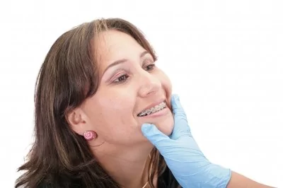 יישור שיניים מדריך